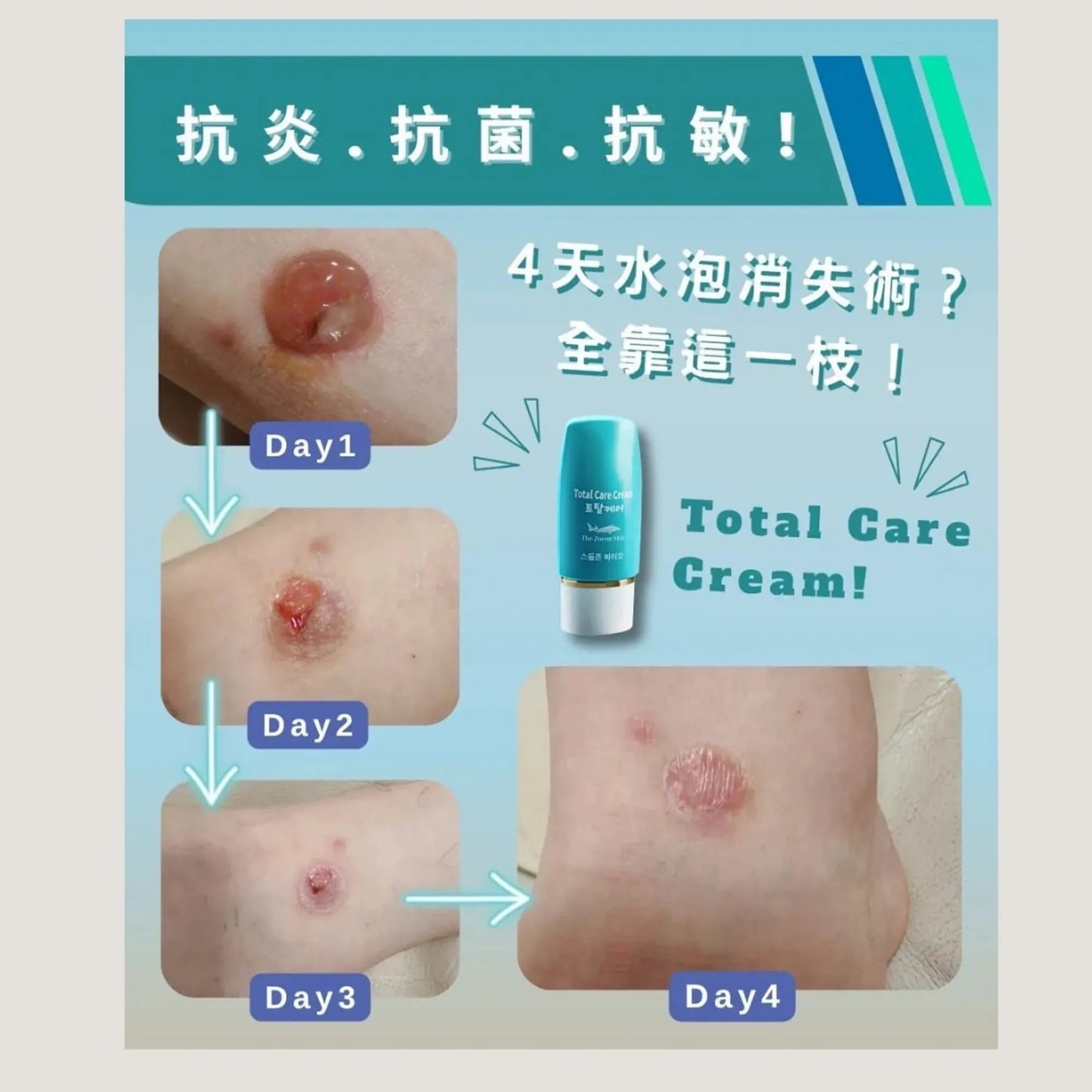 Sturgeon Bio - 鱘魚全能護理凝膠 50ml(一套兩枝裝)